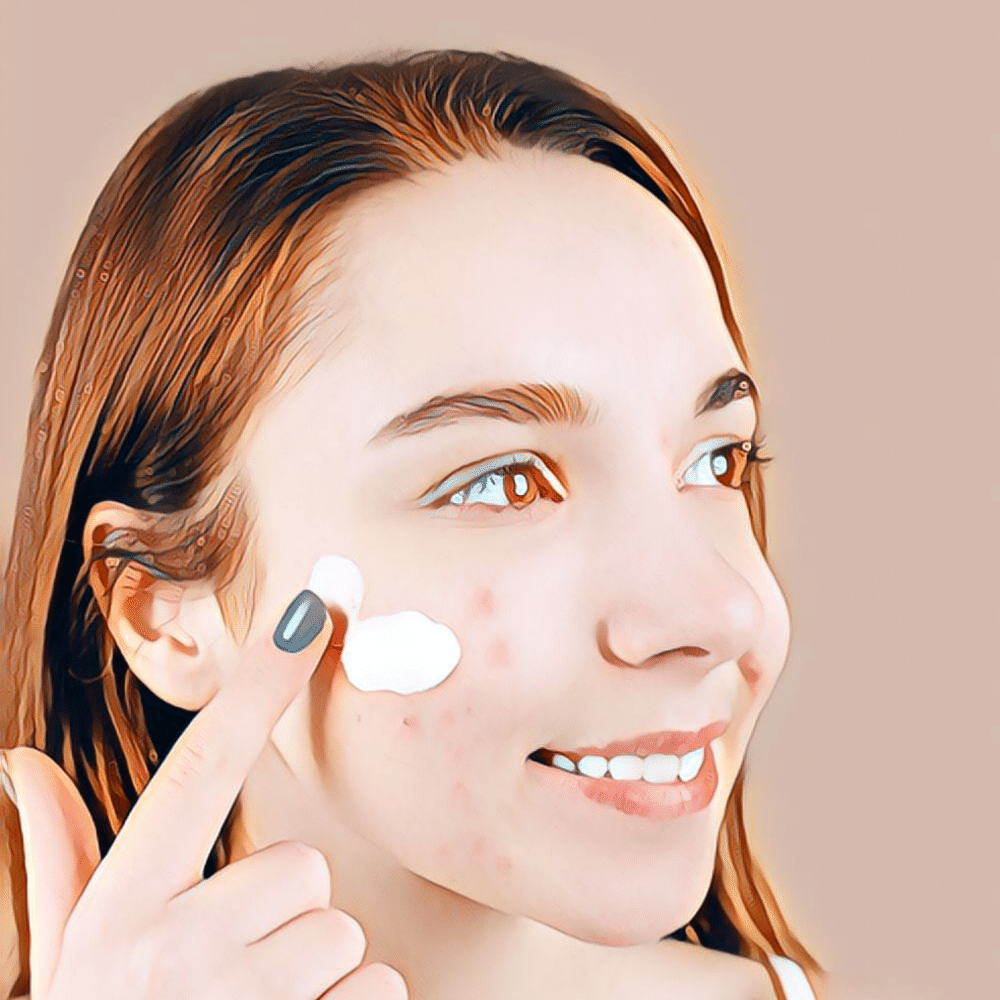 Does Toothpaste Really Help Acne? We Tried It Out!