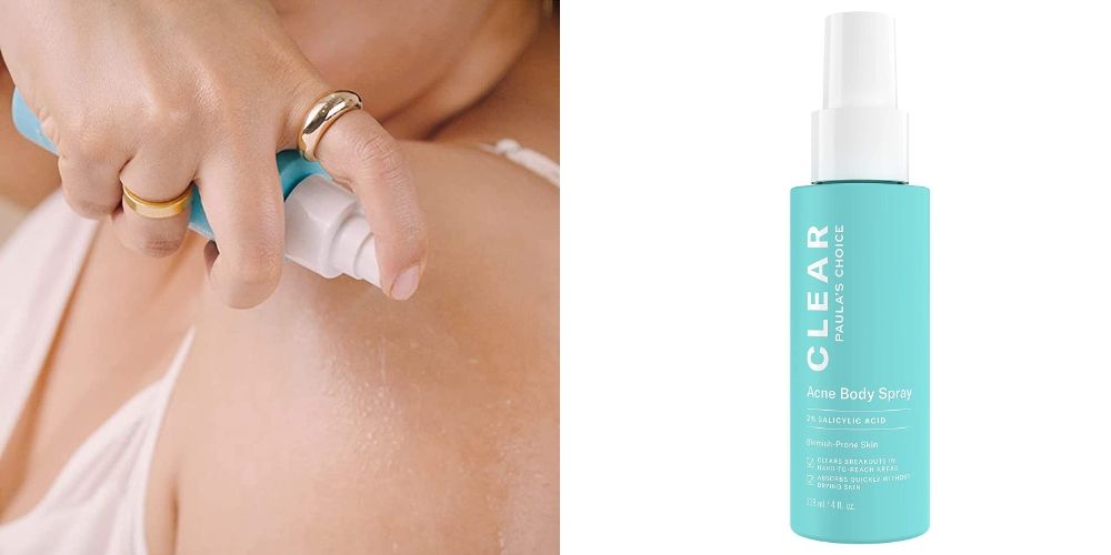 Paula's Choice Clear Back & Body Acne Spray