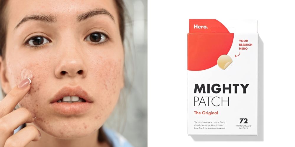 Mighty Patch Pimple Patches