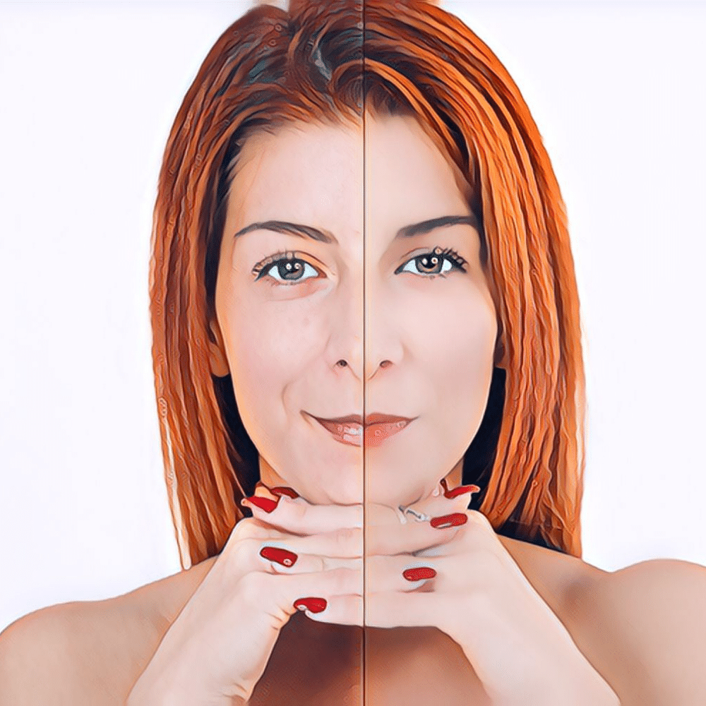 Collagen: Can It Really Help You Look Younger?